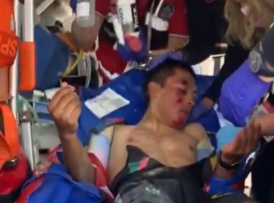 Jonathan Caicedo sufre fuerte caída y se retira del Giro