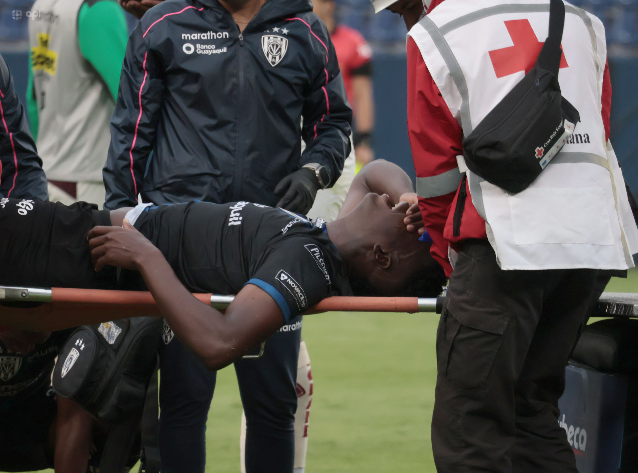 Jean Pierre Arroyo fue operado con éxito tras la grave lesión sufrida ante Mushuc Runa